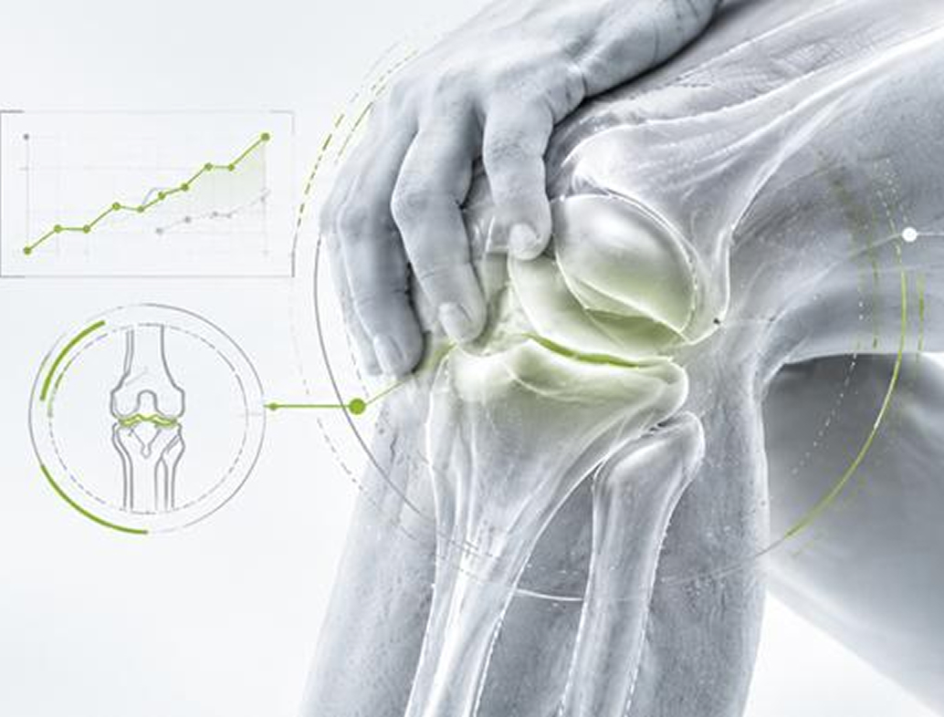 BIOPORT® Crosslink: результаты пострегистрационного исследования при остеоартрите коленного сустава